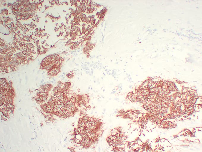 ERBB2 / HER2 Antibody (clone ABT-Her2)