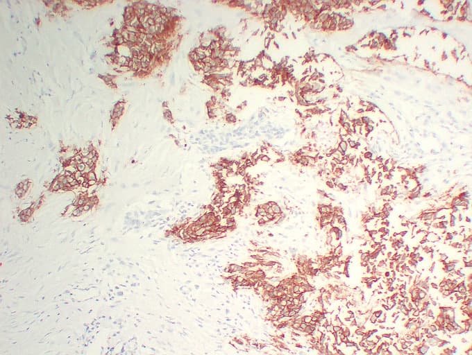ERBB2 / HER2 Antibody (clone ABT-Her2)