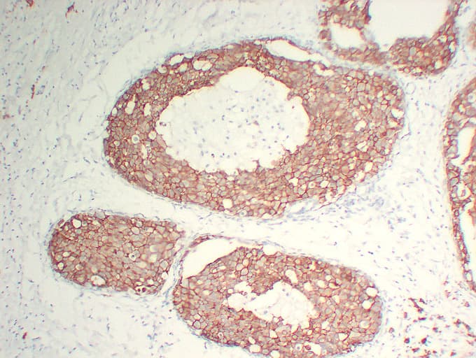 ERBB2 / HER2 Antibody (clone ABT-Her2)