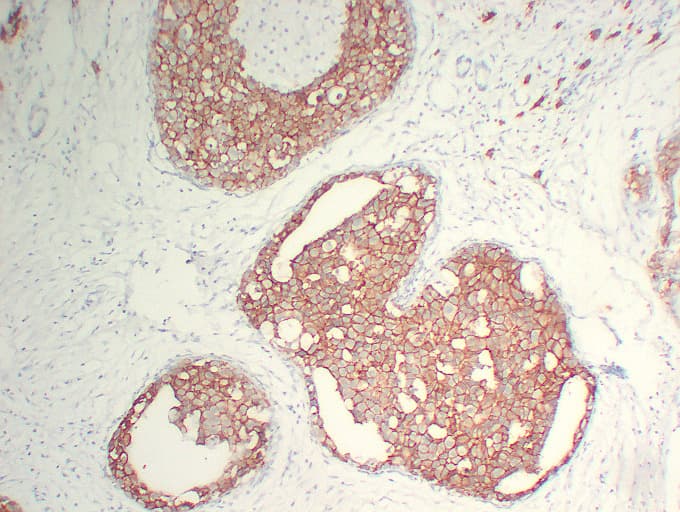 ERBB2 / HER2 Antibody (clone ABT-Her2)