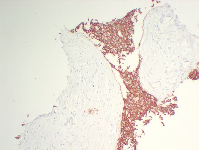 ERBB2 / HER2 Antibody (clone ABT-Her2)