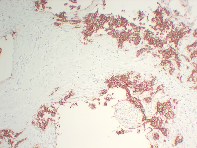ERBB2 / HER2 Antibody (clone ABT-Her2)