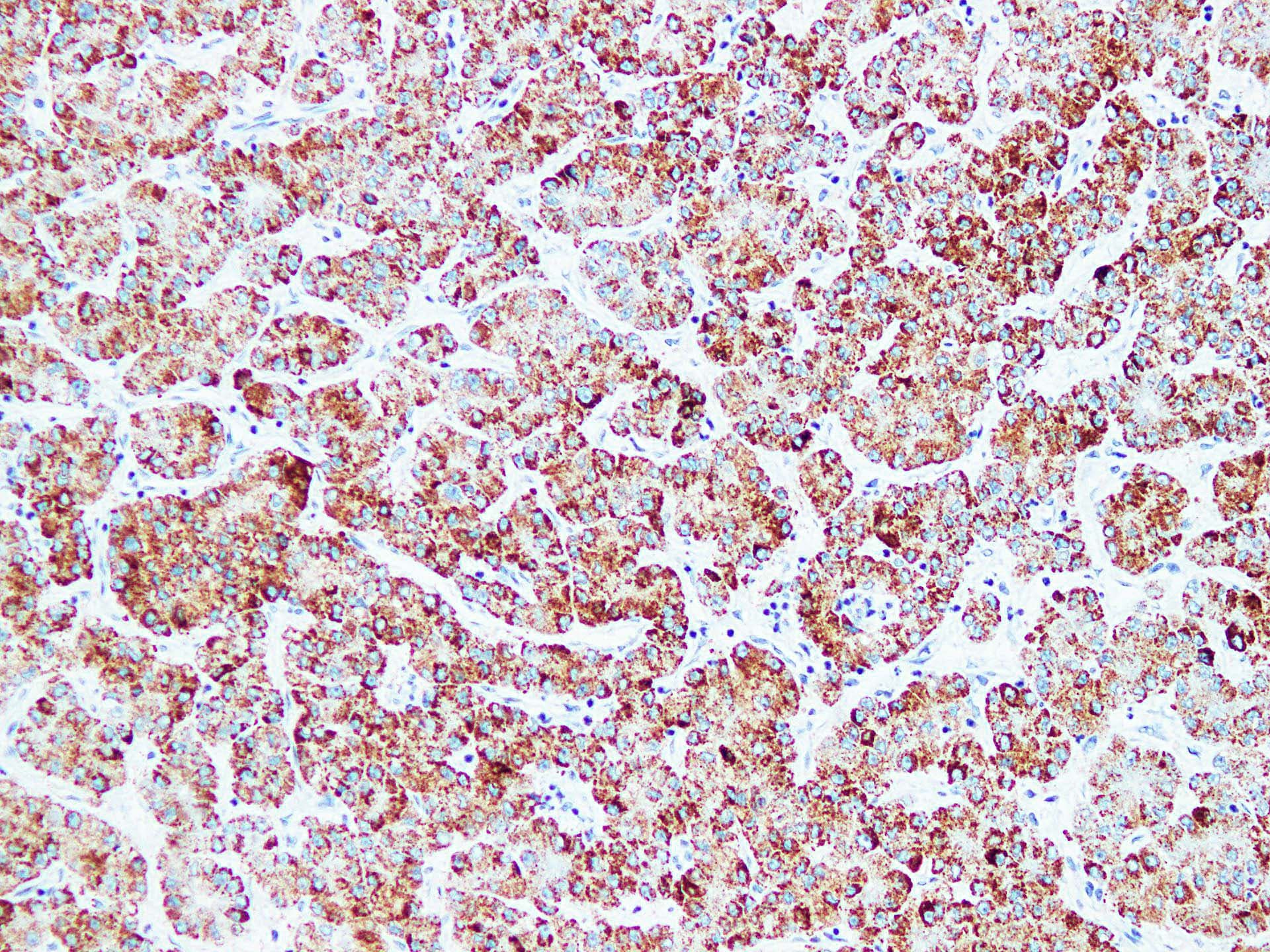 Monoclonal Mouse anti-Human HSPD1 / HSP60 Antibody (clone ABT-HSP60, IHC)