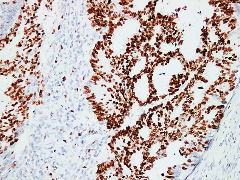 MKI67 / Ki67 Antibody (clone ABT-KI67)