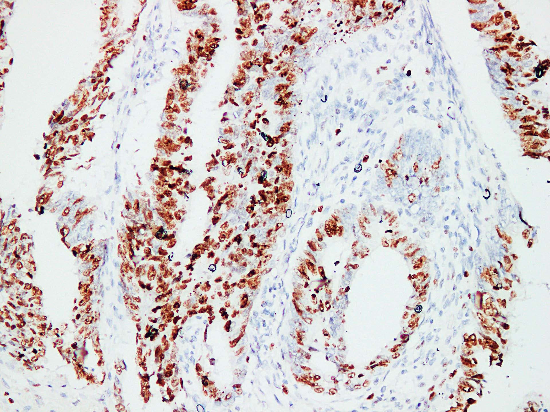 MKI67 / Ki67 Antibody (clone ABT-KI67)