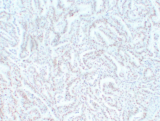 MSH6 Antibody (clone ABT-MSH6)