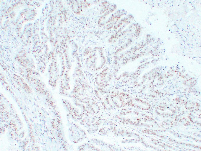 MSH6 Antibody (clone ABT-MSH6)