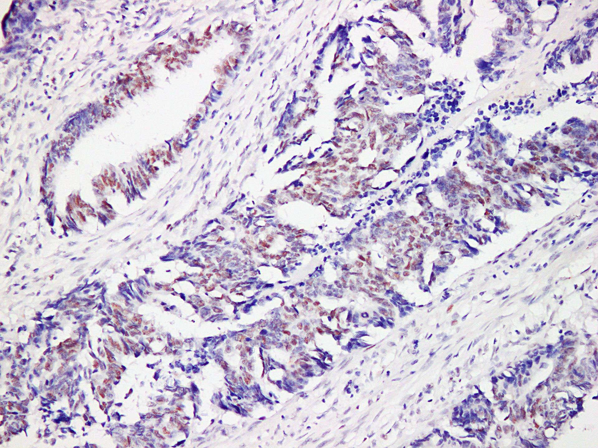 MSH6 Antibody (clone ABT-MSH6)