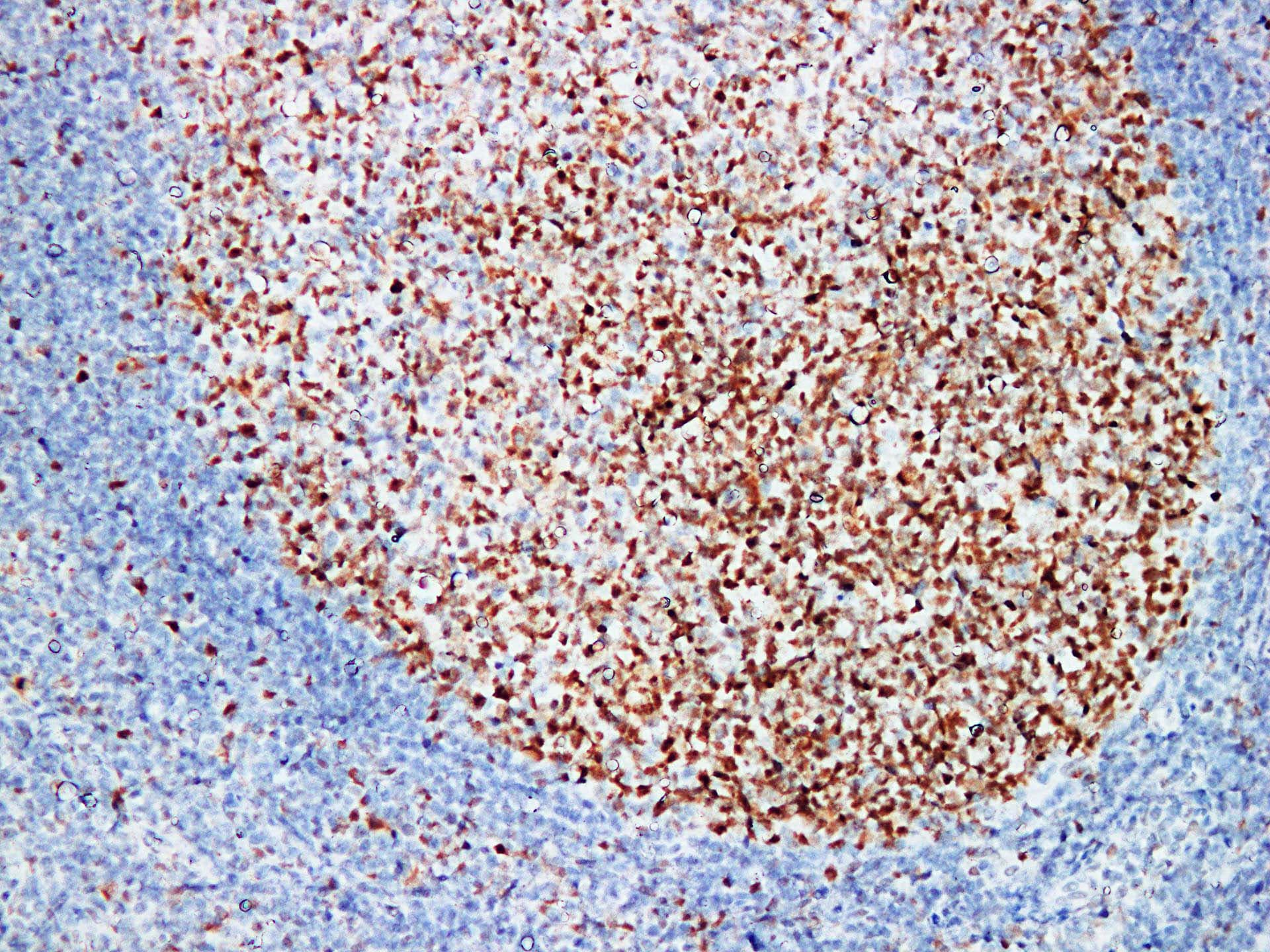 MSH6 Antibody (clone ABT-MSH6)