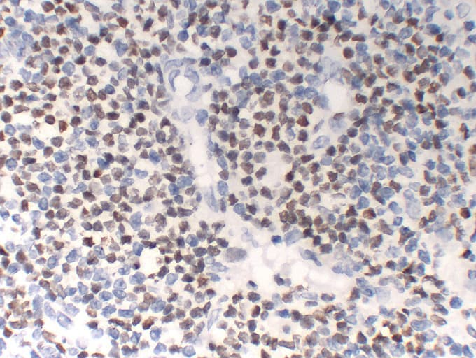 POU2F2 / OCT2 Antibody (clone ABT-OCT2)