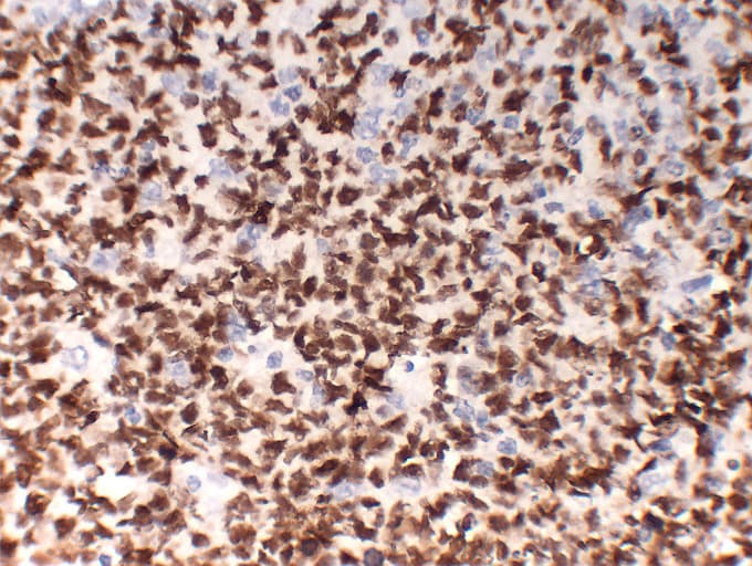 POU2F2 / OCT2 Antibody (clone ABT-OCT2)