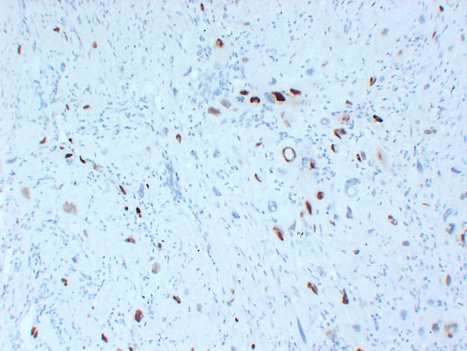 CDKN1C / p57 Kip2 Antibody (clone ABT-P57)