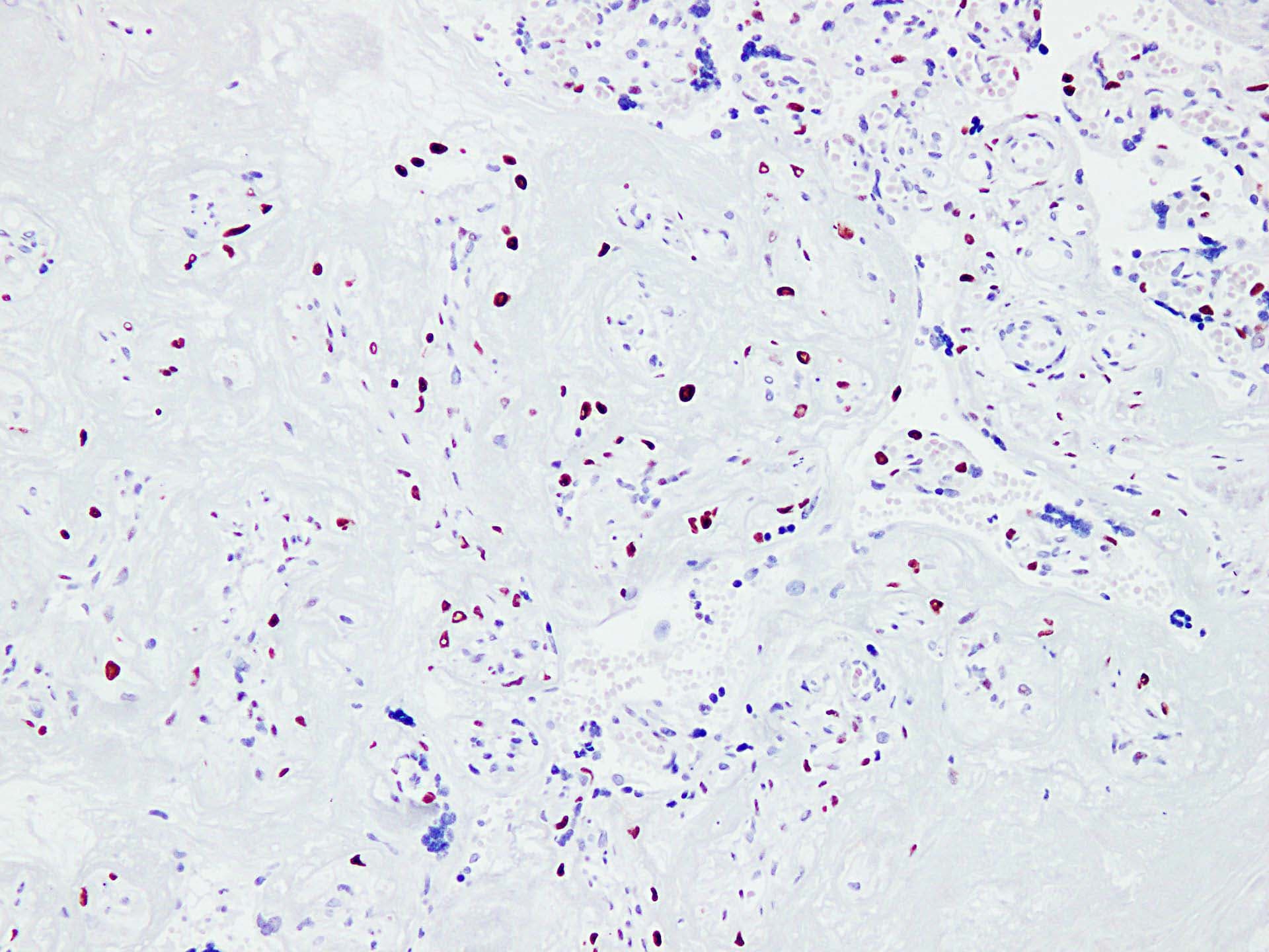 CDKN1C / p57 Kip2 Antibody (clone ABT-P57)