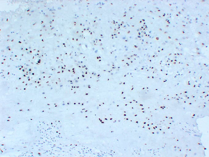 CDKN1C / p57 Kip2 Antibody (clone ABT-P57)