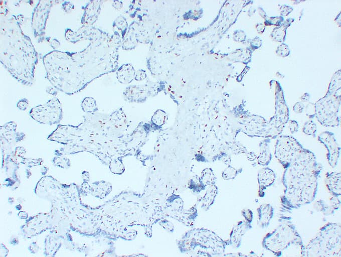 CDKN1C / p57 Kip2 Antibody (clone ABT-P57)