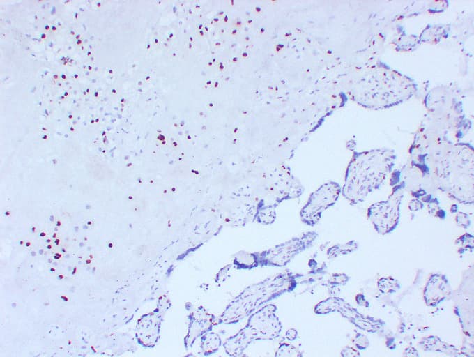 CDKN1C / p57 Kip2 Antibody (clone ABT-P57)