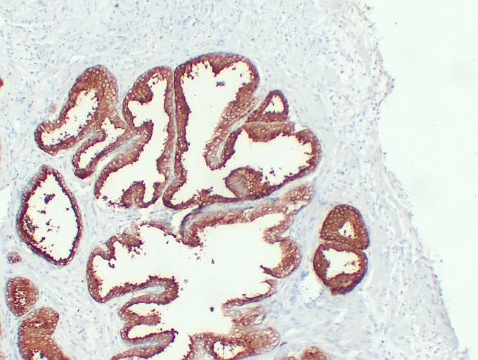 KLK3 / PSA Antibody (clone ABT-PSA)
