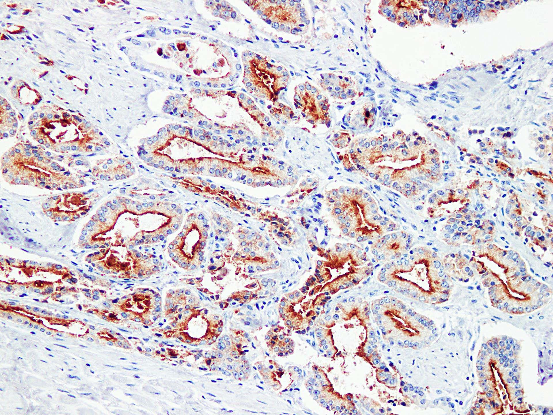 KLK3 / PSA Antibody (clone ABT-PSA)
