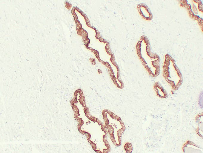KLK3 / PSA Antibody (clone ABT-PSA)