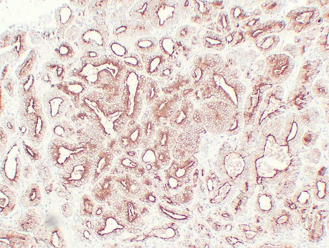 KLK3 / PSA Antibody (clone ABT-PSA)