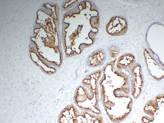 FOLH1 / PSMA Antibody (clone ABT-PSMA)