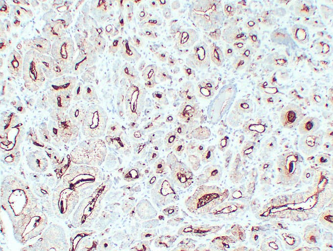 FOLH1 / PSMA Antibody (clone ABT-PSMA)