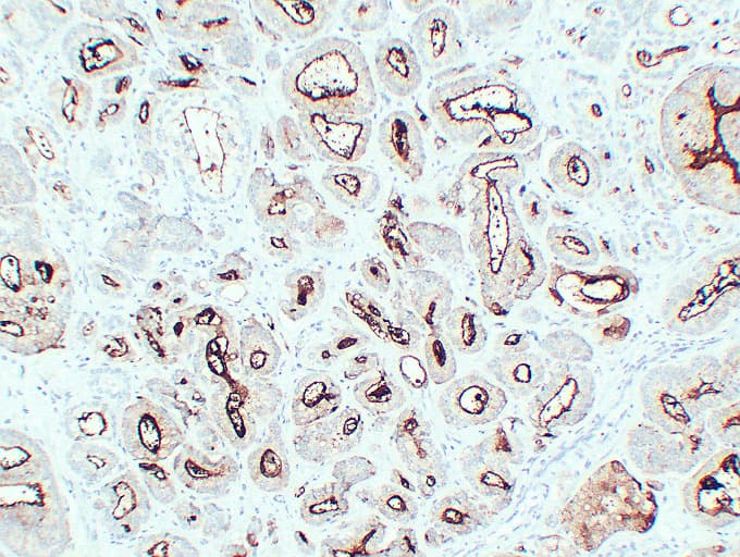 FOLH1 / PSMA Antibody (clone ABT-PSMA)