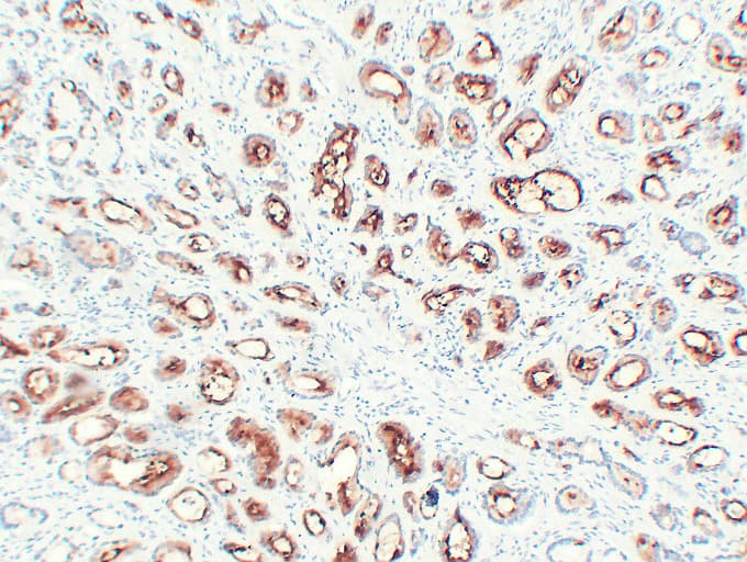 FOLH1 / PSMA Antibody (clone ABT-PSMA)