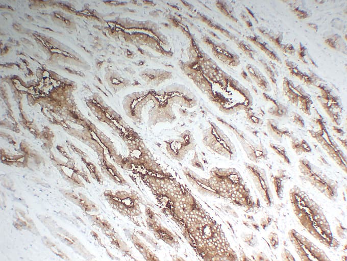 FOLH1 / PSMA Antibody (clone ABT-PSMA)
