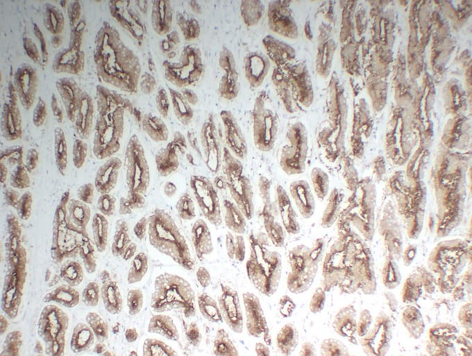 FOLH1 / PSMA Antibody (clone ABT-PSMA)