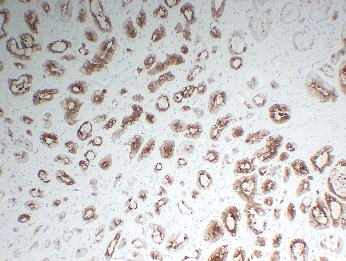 FOLH1 / PSMA Antibody (clone ABT-PSMA)