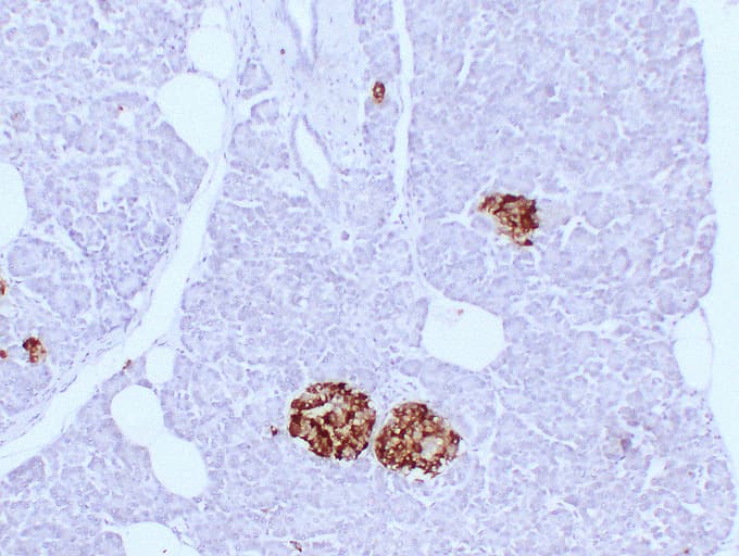 Monoclonal Mouse anti-Human SYP / Synaptophysin Antibody (clone ABT-SYN, IHC)