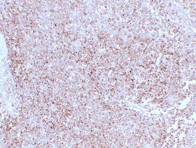 Monoclonal Mouse anti-Human SYP / Synaptophysin Antibody (clone ABT-SYN, IHC)