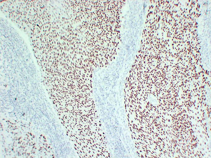 TP63 / p63 Antibody (clone ABT-P40)