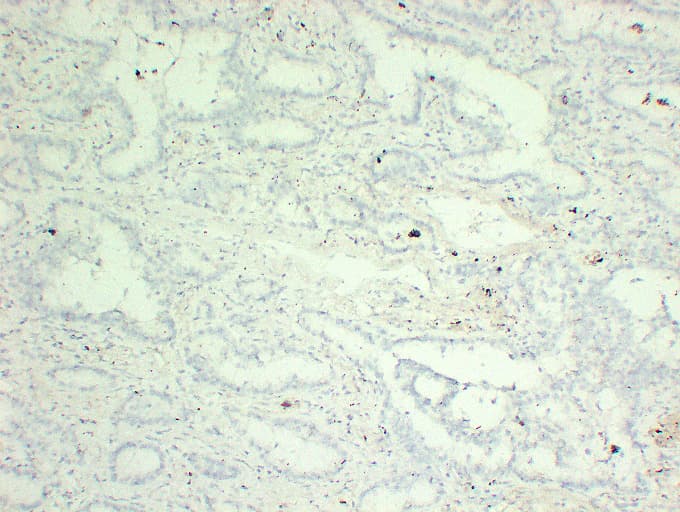 TP63 / p63 Antibody (clone ABT-P40)