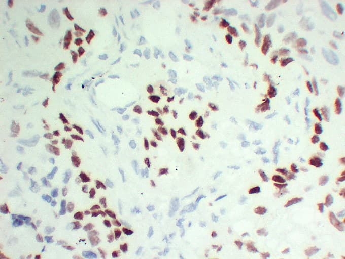 TP63 / p63 Antibody (clone ABT-P40)