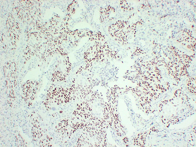 TP63 / p63 Antibody (clone ABT-P40)