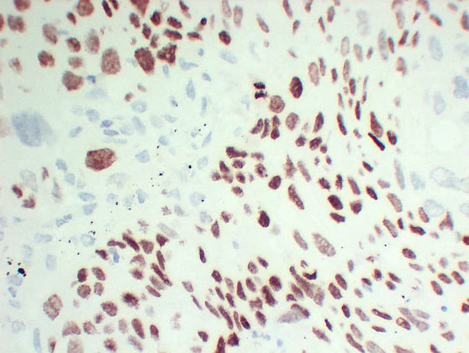 TP63 / p63 Antibody (clone ABT-P40)