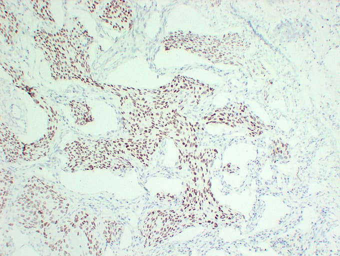 TP63 / p63 Antibody (clone ABT-P40)