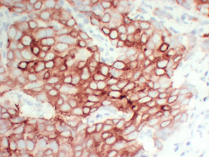 Monoclonal Mouse anti-Human TFF1 / pS2 Antibody (clone ABT-PS2, IHC)