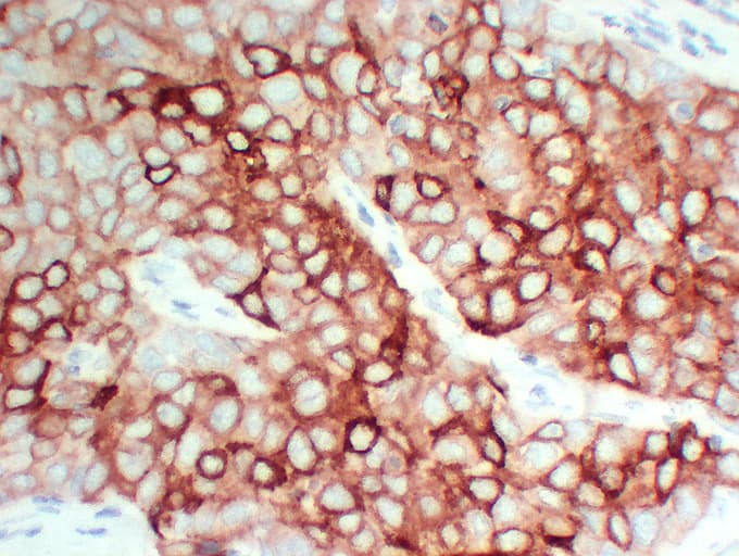 Monoclonal Mouse anti-Human TFF1 / pS2 Antibody (clone ABT-PS2, IHC)