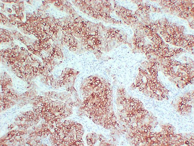 Monoclonal Mouse anti-Human TFF1 / pS2 Antibody (clone ABT-PS2, IHC)