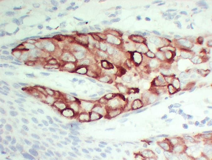Monoclonal Mouse anti-Human TFF1 / pS2 Antibody (clone ABT-PS2, IHC)