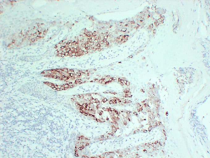 Monoclonal Mouse anti-Human TFF1 / pS2 Antibody (clone ABT-PS2, IHC)
