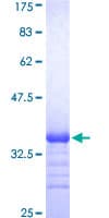 Human ADGRE4P / EMR4P Protein (Recombinant GST)