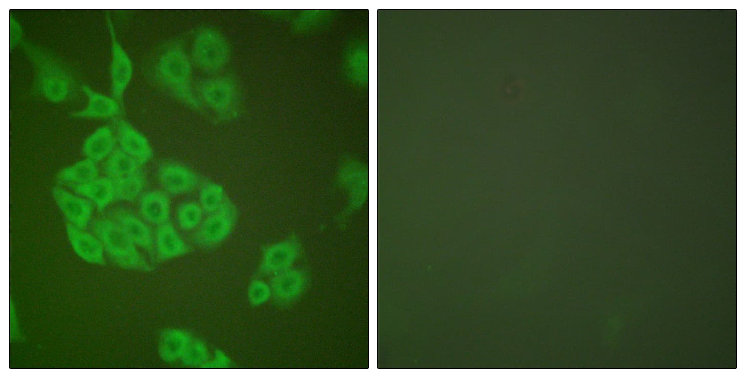 IHC-plus™ Polyclonal Rabbit anti-Human MMP11 Antibody (aa61-110, IHC, IF, WB)