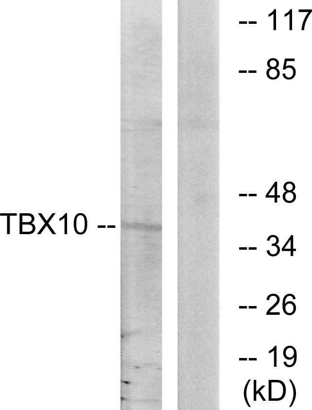 TBX10 Antibody (aa261-310)
