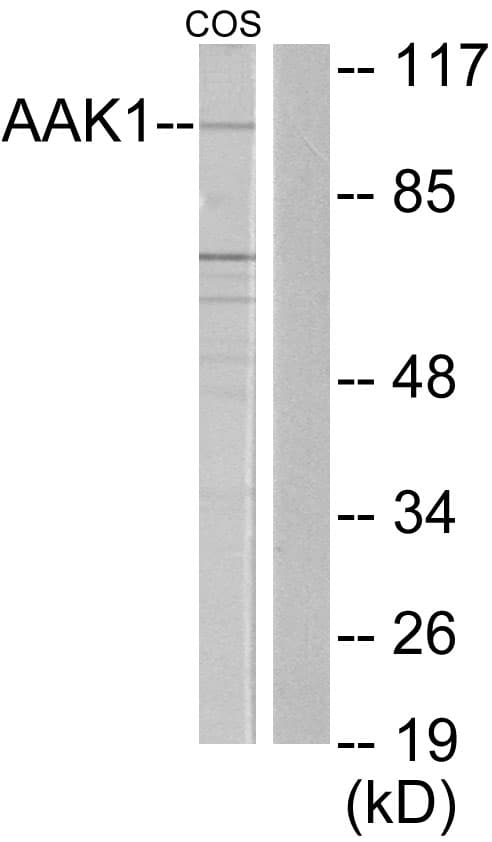 AAK1 Antibody (aa271-320)