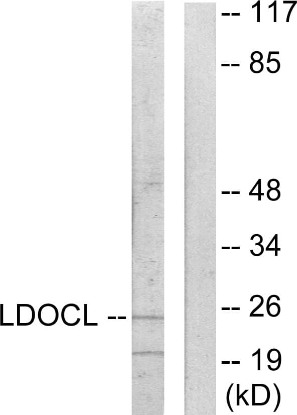 IHC-plus™ LDOC1L Antibody (aa141-190)