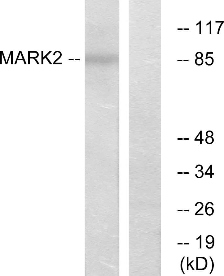 IHC-plus™ Polyclonal Rabbit anti-Human MARK2 Antibody (aa10-59, IHC, IF, WB)